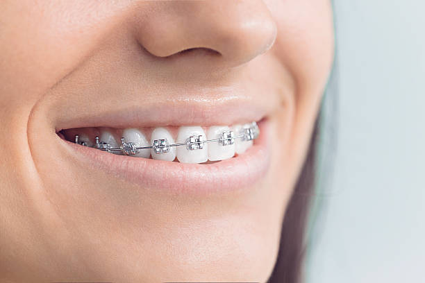 Best Dental Fillings (Composite and Amalgam)  in Galax, VA
